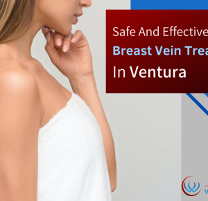 Safe And Effective Breast Vein Treatment In Ventura