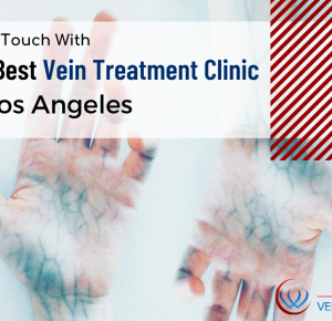 Choosing the Right Vein Treatment Center for Your Chronic Venous Disease: