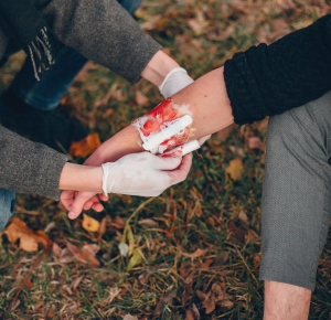 Understanding Bleeding Varicose Veins: Causes, Symptoms, and Effective Treatment Options