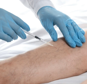 How Vein Treatment Centers Can Help You Say Goodbye to Varicose Veins with Modern Solutions