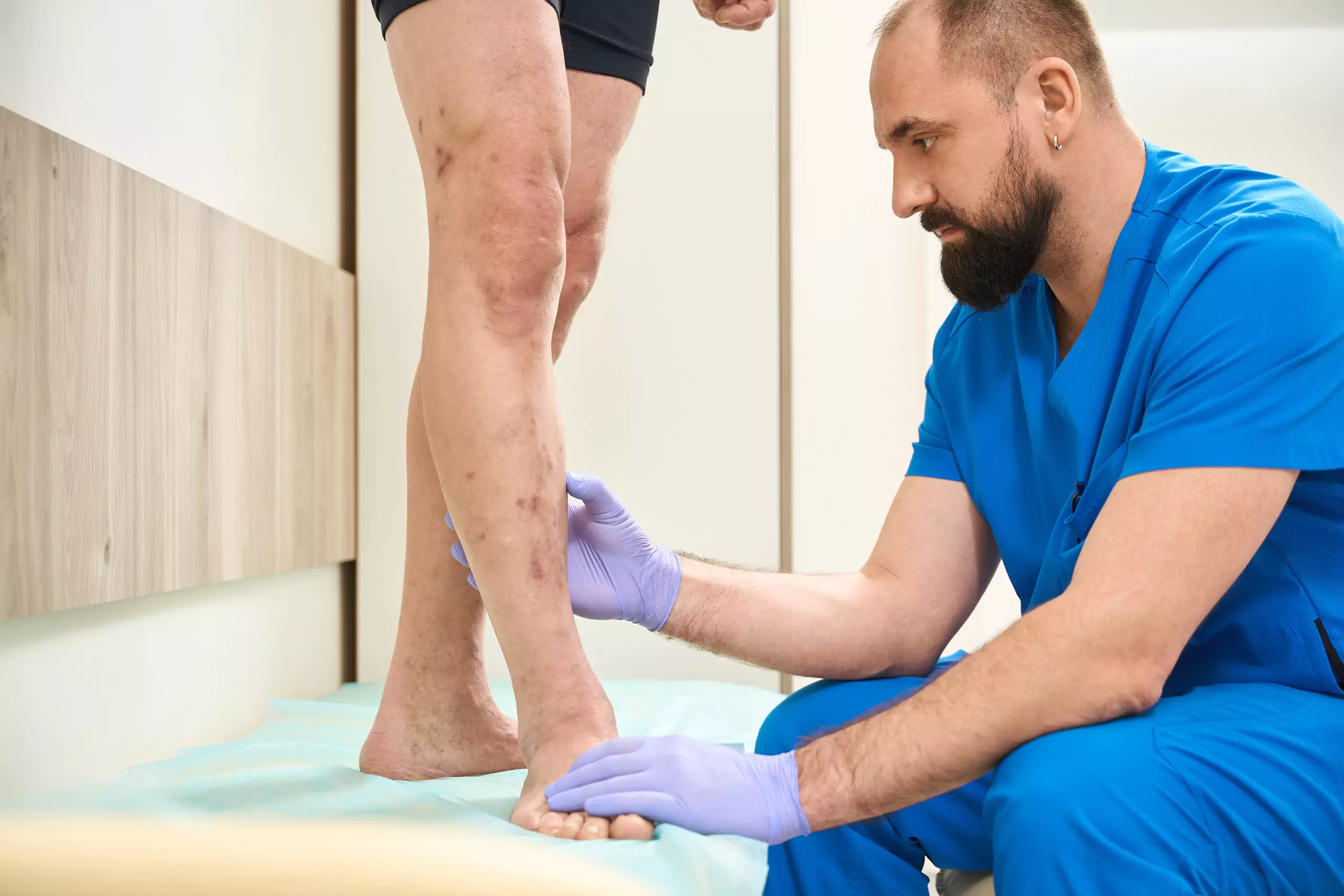 veinsurgery1