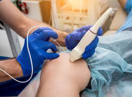 veinsurgery