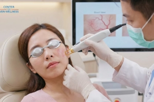 How to Care for Your Skin After Facial Vein Treatment